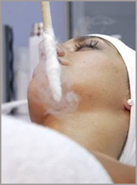 Криотерапия