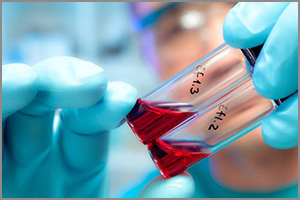 Плазмотерапия